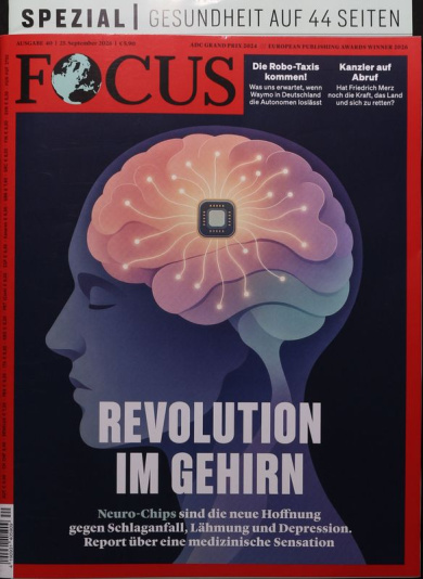 FOCUS